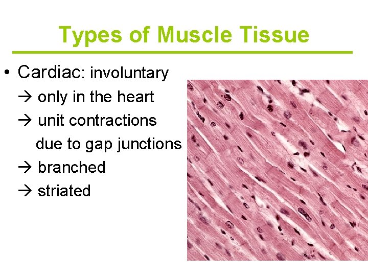 Types of Muscle Tissue • Cardiac: involuntary only in the heart unit contractions due