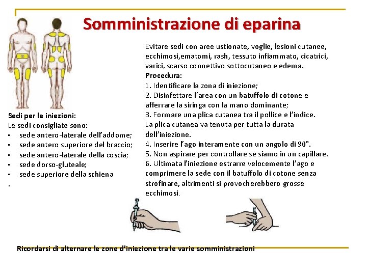 Somministrazione di eparina Sedi per le iniezioni: Le sedi consigliate sono: • sede antero-laterale Somministrazione di eparina Sedi per le iniezioni: Le sedi consigliate sono: • sede antero-laterale