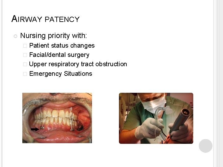 AIRWAY PATENCY Nursing priority with: � Patient status changes � Facial/dental surgery � Upper