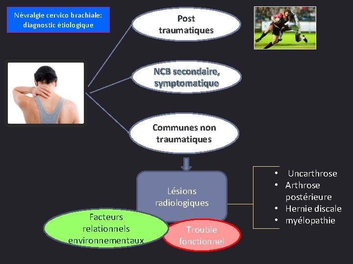 Névralgie cervico brachiale: diagnostic étiologique Post traumatiques NCB secondaire, symptomatique Communes non traumatiques Lésions