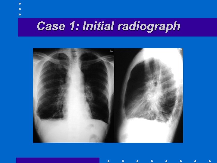 Case 1: Initial radiograph 