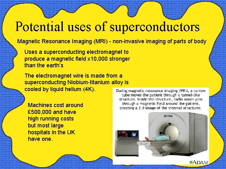 Potential uses of superconductors Magnetic Resonance Imaging (MRI) - non-invasive imaging of parts of
