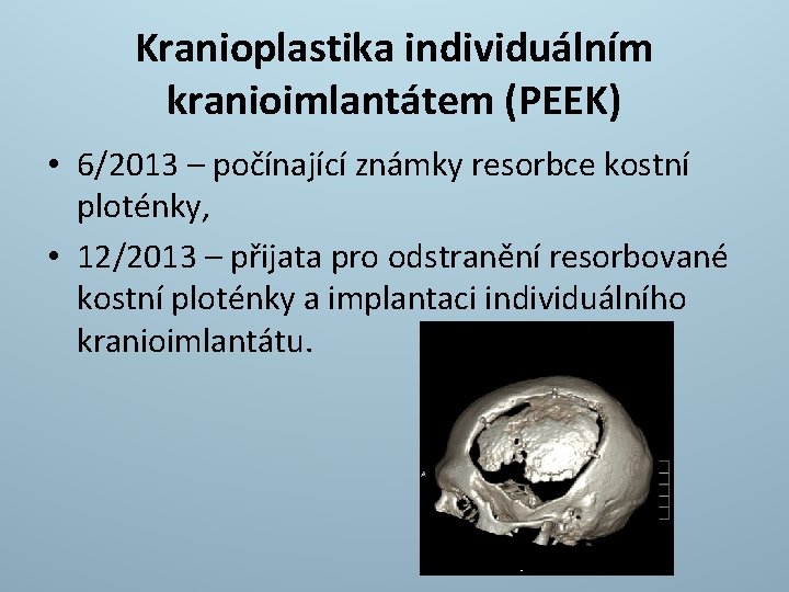 Kranioplastika individuálním kranioimlantátem (PEEK) • 6/2013 – počínající známky resorbce kostní ploténky, • 12/2013