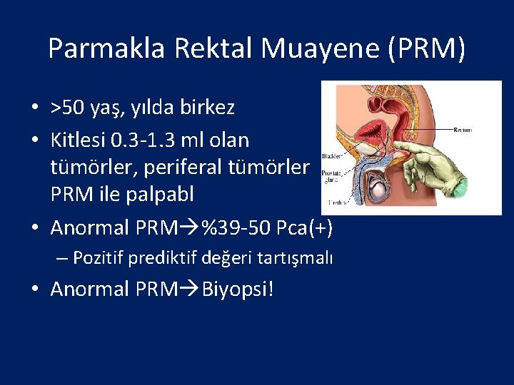 Parmakla Rektal Muayene (PRM) • >50 yaş, yılda birkez • Kitlesi 0. 3 -1.