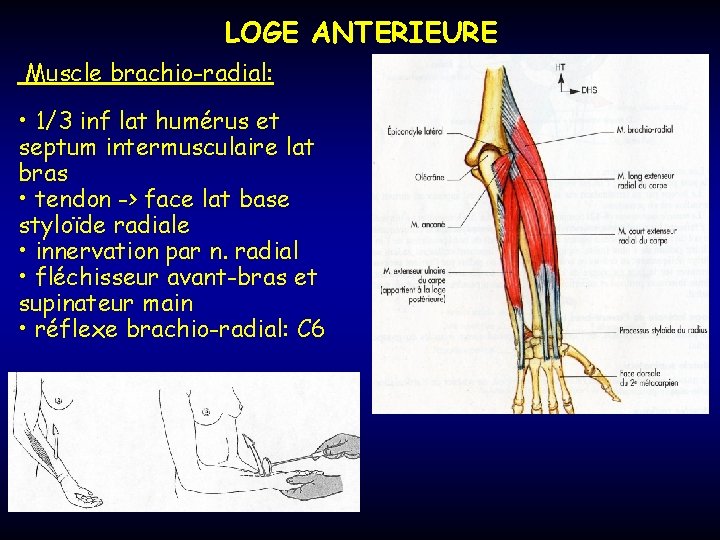 LOGE ANTERIEURE Muscle brachio-radial: • 1/3 inf lat humérus et septum intermusculaire lat bras