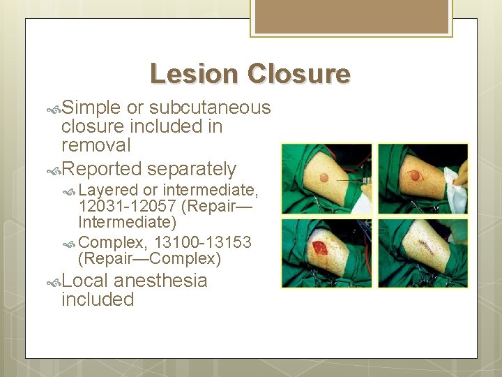 Lesion Closure Simple or subcutaneous closure included in removal Reported separately Layered or intermediate,