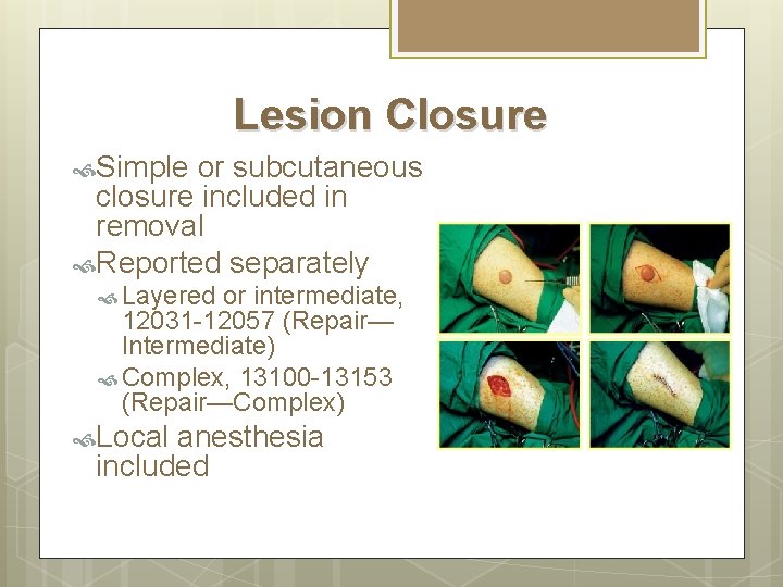 Lesion Closure Simple or subcutaneous closure included in removal Reported separately Layered or intermediate, Lesion Closure Simple or subcutaneous closure included in removal Reported separately Layered or intermediate,