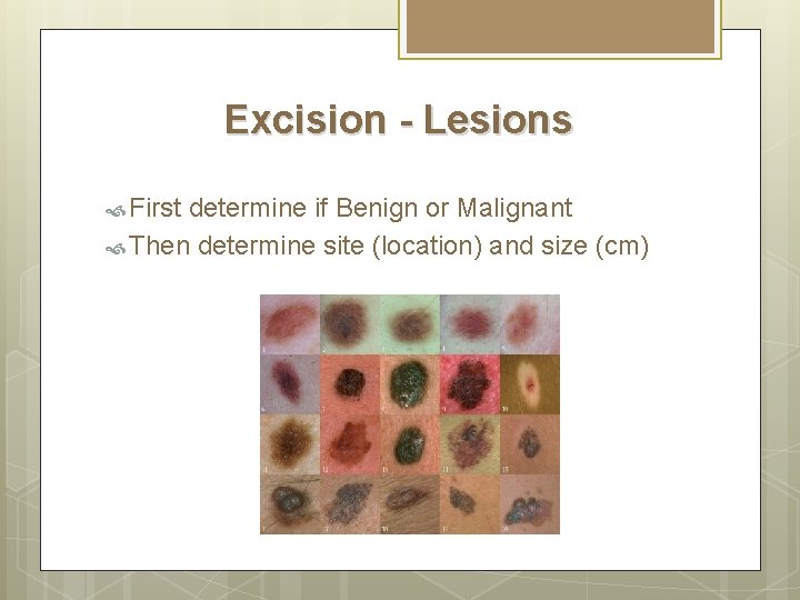 Excision - Lesions First determine if Benign or Malignant Then determine site (location) and