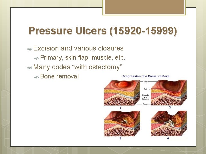 Pressure Ulcers (15920 -15999) Excision and various closures Primary, Many skin flap, muscle, etc. Pressure Ulcers (15920 -15999) Excision and various closures Primary, Many skin flap, muscle, etc.