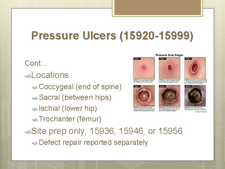Pressure Ulcers (15920 -15999) Cont… Locations Coccygeal (end of spine) Sacral (between hips) Ischial Pressure Ulcers (15920 -15999) Cont… Locations Coccygeal (end of spine) Sacral (between hips) Ischial