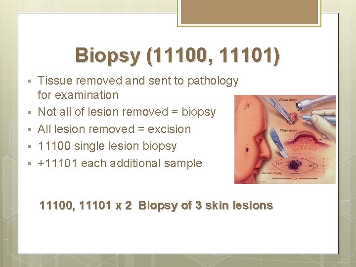Biopsy (11100, 11101) § § § Tissue removed and sent to pathology for examination Biopsy (11100, 11101) § § § Tissue removed and sent to pathology for examination