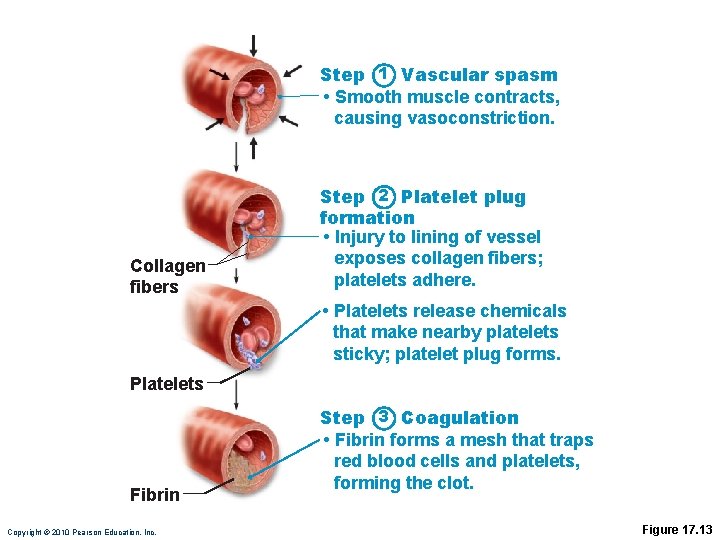 Step 1 Vascular spasm • Smooth muscle contracts, causing vasoconstriction. Collagen fibers Step 2