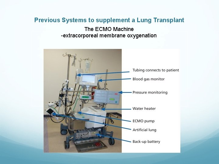 Previous Systems to supplement a Lung Transplant The ECMO Machine -extracorporeal membrane oxygenation 