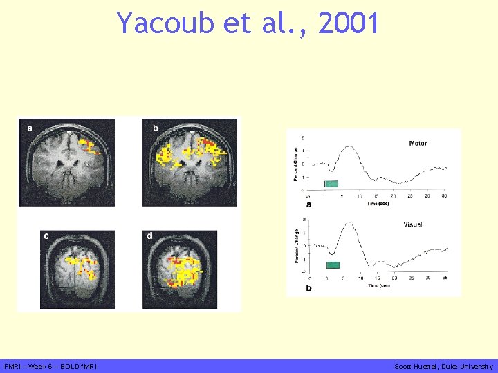 Yacoub et al. , 2001 FMRI – Week 6 – BOLD f. MRI Scott