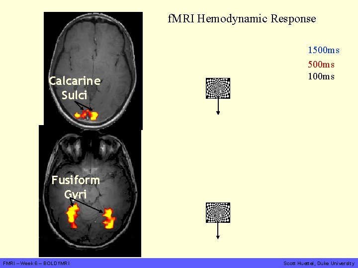 f. MRI Hemodynamic Response Calcarine Sulci 1500 ms 100 ms Fusiform Gyri FMRI –