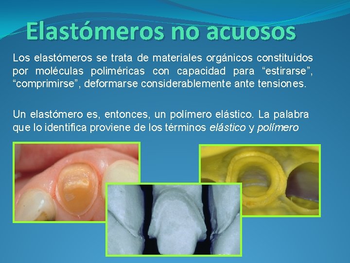Elastómeros no acuosos Los elastómeros se trata de materiales orgánicos constituidos por moléculas poliméricas