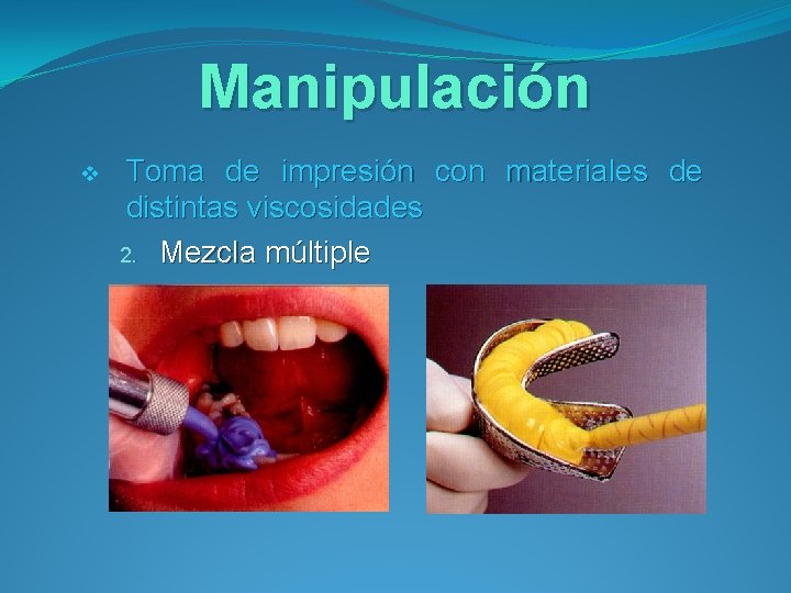 Manipulación v Toma de impresión con materiales de distintas viscosidades 2. Mezcla múltiple 