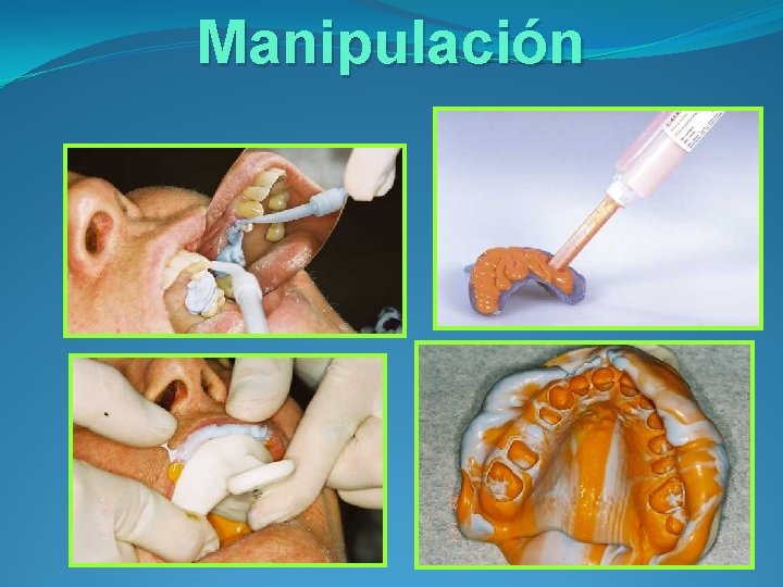 Manipulación 