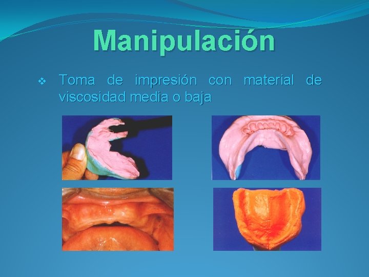 Manipulación v Toma de impresión con material de viscosidad media o baja 