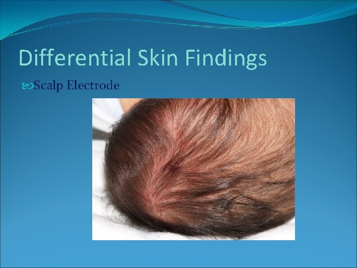 Differential Skin Findings Scalp Electrode Differential Skin Findings Scalp Electrode