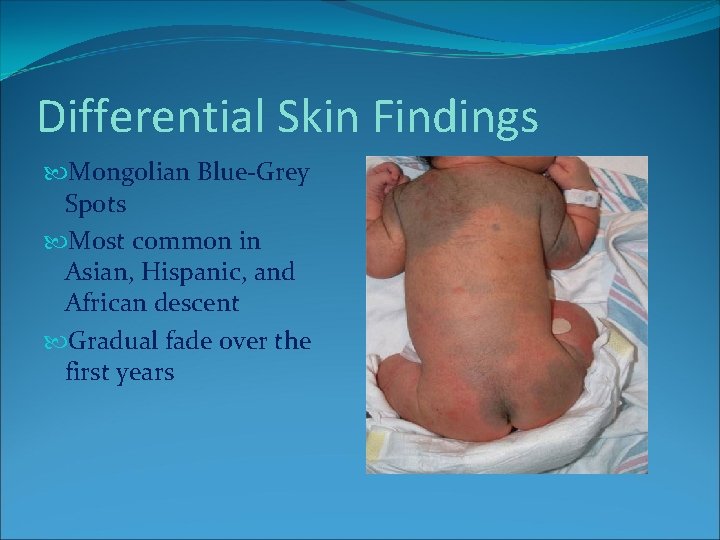 Differential Skin Findings Mongolian Blue-Grey Spots Most common in Asian, Hispanic, and African descent Differential Skin Findings Mongolian Blue-Grey Spots Most common in Asian, Hispanic, and African descent
