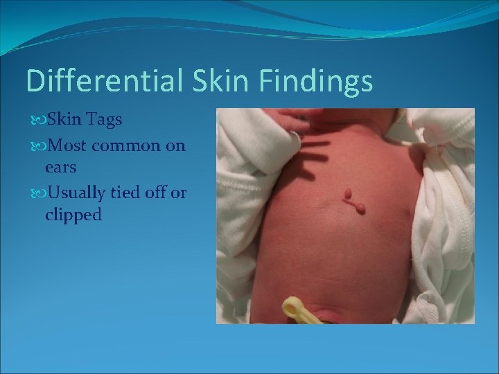 Differential Skin Findings Skin Tags Most common on ears Usually tied off or clipped Differential Skin Findings Skin Tags Most common on ears Usually tied off or clipped