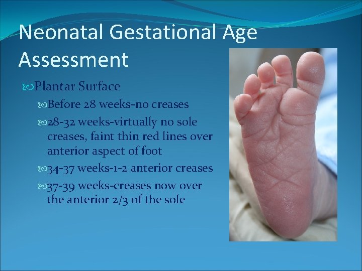 Neonatal Gestational Age Assessment Plantar Surface Before 28 weeks-no creases 28 -32 weeks-virtually no Neonatal Gestational Age Assessment Plantar Surface Before 28 weeks-no creases 28 -32 weeks-virtually no