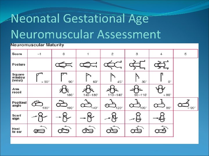 Neonatal Gestational Age Neuromuscular Assessment Neonatal Gestational Age Neuromuscular Assessment