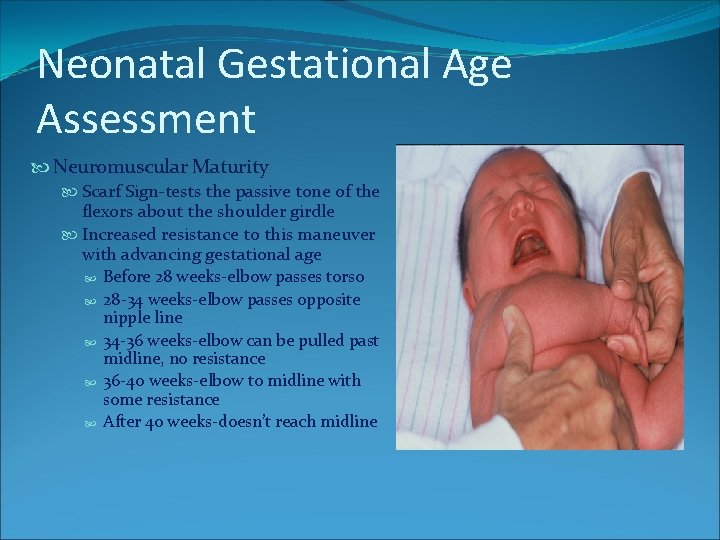 Neonatal Gestational Age Assessment Neuromuscular Maturity Scarf Sign-tests the passive tone of the flexors Neonatal Gestational Age Assessment Neuromuscular Maturity Scarf Sign-tests the passive tone of the flexors