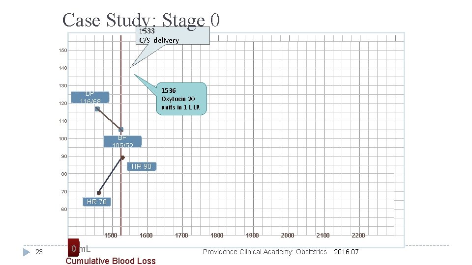 Case Study: Stage 0 1533 C/S delivery 150 140 130 120 1536 Oxytocin 20