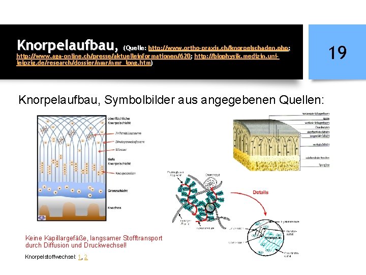 Knorpelaufbau, (Quelle: http: //www. ortho-praxis. ch/knorpelschaden. php; http: //www. aga-online. ch/presse/aktuelleinformationen/620; http: //biophysik. medizin.