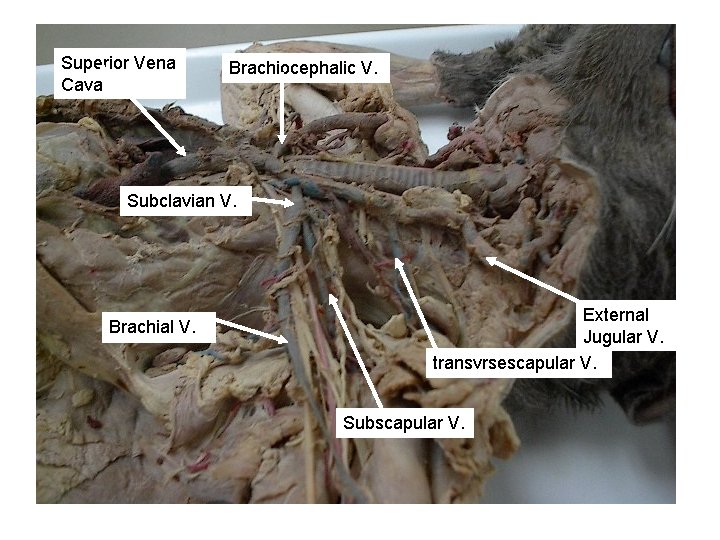 Superior Vena Cava Brachiocephalic V. Subclavian V. Brachial V. External Jugular V. transvrsescapular V. Superior Vena Cava Brachiocephalic V. Subclavian V. Brachial V. External Jugular V. transvrsescapular V.