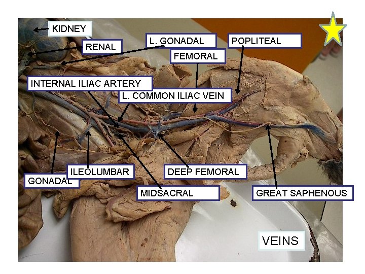 KIDNEY RENAL L. GONADAL POPLITEAL FEMORAL INTERNAL ILIAC ARTERY L. COMMON ILIAC VEIN ILEOLUMBAR