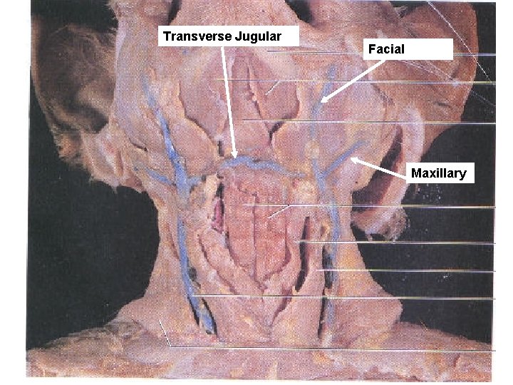 Transverse Jugular Facial Maxillary Transverse Jugular Facial Maxillary
