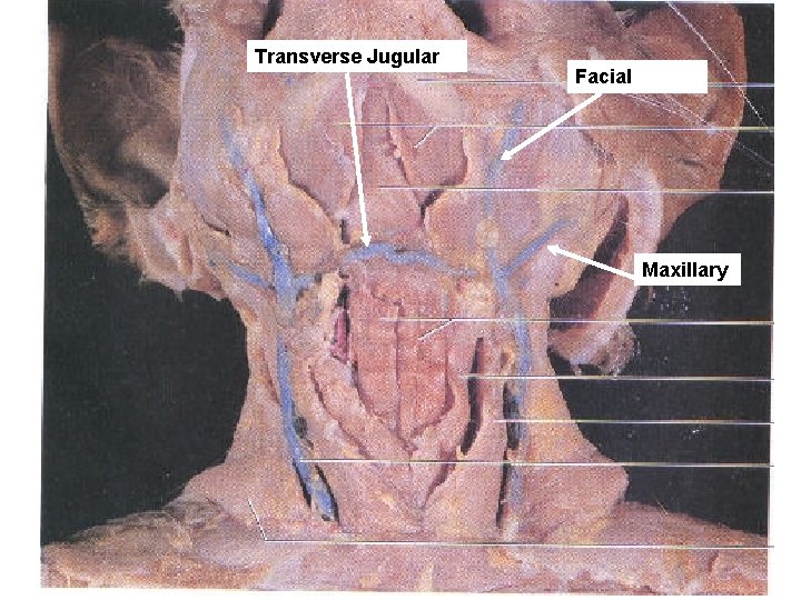 Transverse Jugular Facial Maxillary 