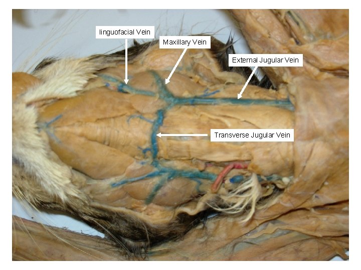 linguofacial Vein Maxillary Vein External Jugular Vein Transverse Jugular Vein 