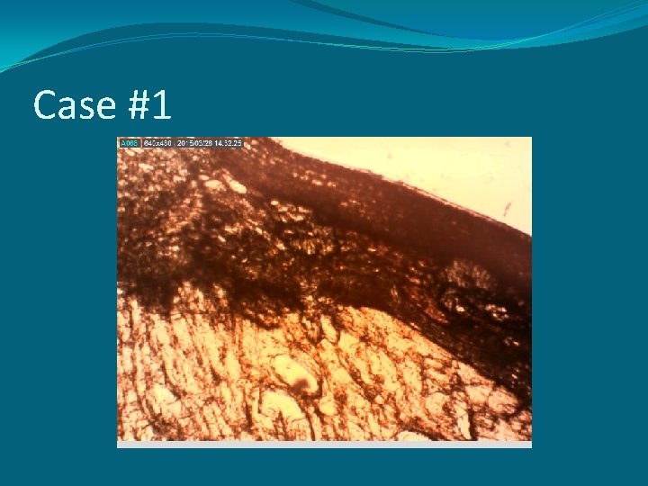 Case #1 