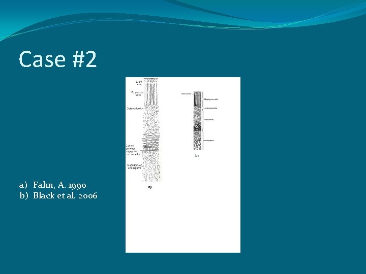Case #2 a) Fahn, A. 1990 b) Black et al. 2006 