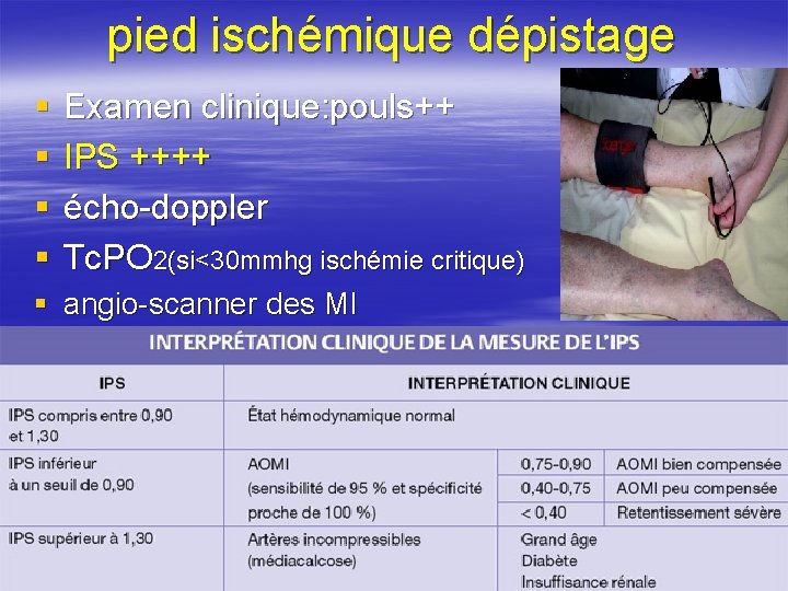 pied ischémique dépistage § § Examen clinique: pouls++ IPS ++++ écho-doppler Tc. PO 2(si<30