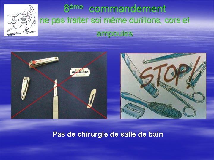 8ème commandement ne pas traiter soi même durillons, cors et ampoules Pas de chirurgie