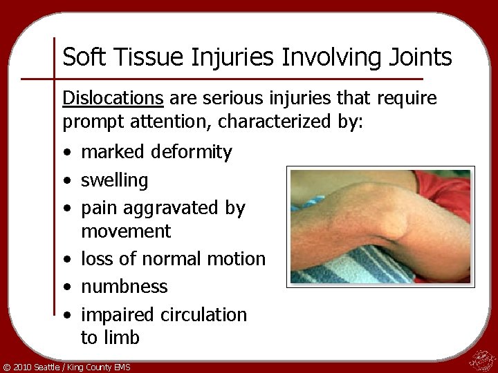 Soft Tissue Injuries Involving Joints Dislocations are serious injuries that require prompt attention, characterized