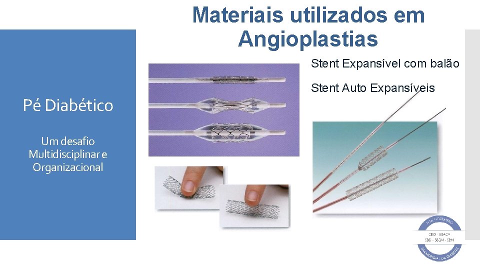 Materiais utilizados em Angioplastias Stent Expansível com balão Pé Diabético Um desafio Multidisciplinar e
