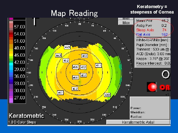 Map Reading Keratometry = steepness of Cornea 