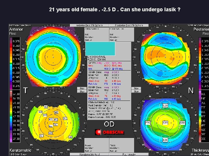 21 years old female. -2. 5 D. Can she undergo lasik ? 