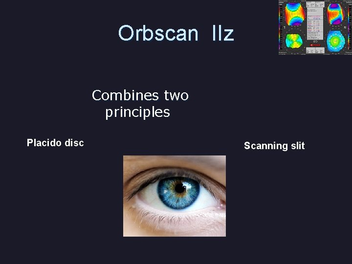 Orbscan IIz Combines two principles Placido disc Scanning slit 