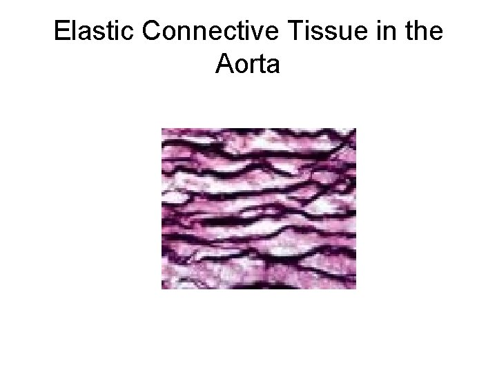 Elastic Connective Tissue in the Aorta 