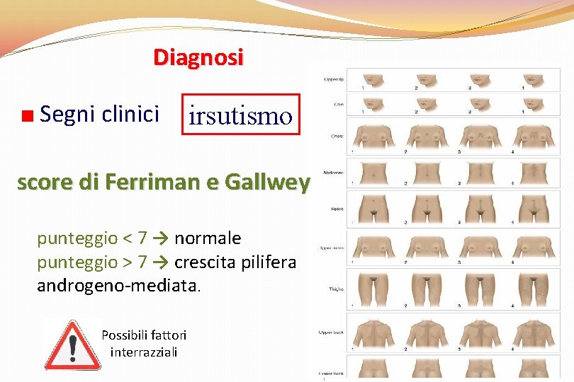 Diagnosi Segni clinici irsutismo score di Ferriman e Gallwey punteggio < 7 → normale