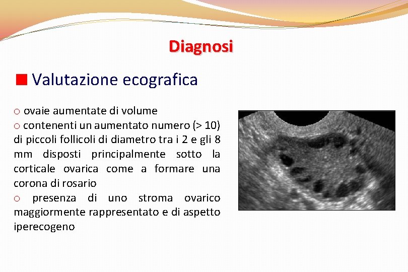 Diagnosi Valutazione ecografica o ovaie aumentate di volume o contenenti un aumentato numero (>