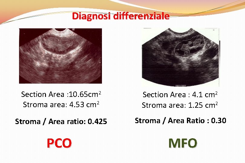 Diagnosi differenziale Section Area : 10. 65 cm 2 Stroma area: 4. 53 cm