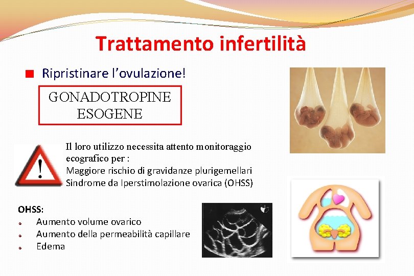 Trattamento infertilità Ripristinare l’ovulazione! GONADOTROPINE ESOGENE Il loro utilizzo necessita attento monitoraggio ecografico per